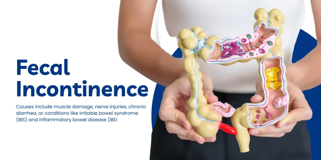 Types of incontinence